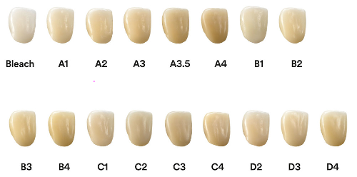 tooth color